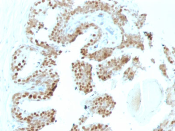 p57Kip2 (Mitotic Inhibitor/Suppressor Protein) Antibody - With BSA and Azide