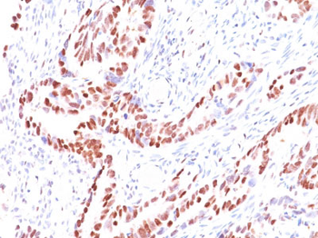 p57Kip2 (Mitotic Inhibitor/Suppressor Protein) Antibody - With BSA and Azide