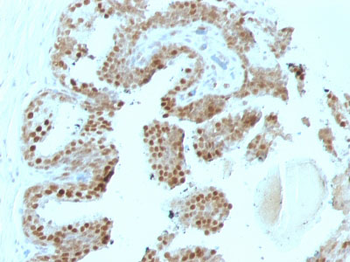 p57Kip2 (Mitotic Inhibitor/Suppressor Protein) Antibody - With BSA and Azide