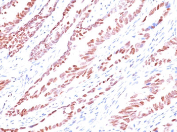p57Kip2 (Mitotic Inhibitor/Suppressor Protein) Antibody - With BSA and Azide