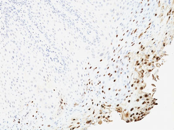 HPV-16 (Human Papilloma Virus 16) Antibody - With BSA and Azide