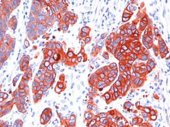 Cytokeratin, Multi (Epithelial Marker) Antibody - With BSA and Azide