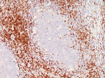 CD6 Antibody - With BSA and Azide