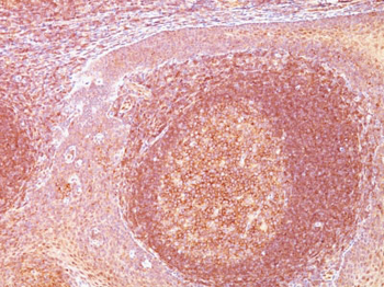 BCL10 (MALT-Lymphoma Marker) Antibody - With BSA and Azide