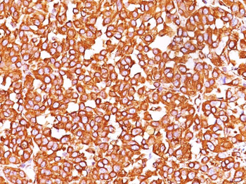 Vimentin (Mesenchymal Cell Marker) Antibody - With BSA and Azide