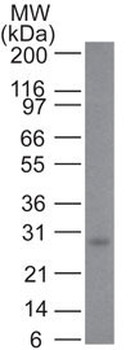 Bcl-2 (Apoptosis & Follicular Lymphoma Marker) Antibody - With BSA and Azide