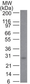 Bcl-2 (Apoptosis & Follicular Lymphoma Marker) Antibody - With BSA and Azide