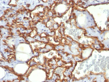 CD31 / PECAM-1 (Endothelial Cell Marker) Antibody - With BSA and Azide