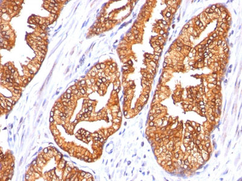 Ornithine Decarboxylase-1 (ODC-1) Antibody - With BSA and Azide