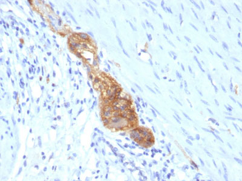 CD56 / NCAM1 / NKH1 (Neuronal Cell Marker) Antibody - With BSA and Azide