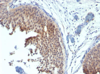 Cytokeratin 6 (KRT6) (Hyperproliferation-Related Keratin) Antibody - With BSA and Azide