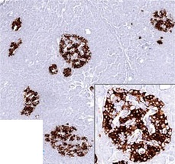 Insulin / IRDN (beta-Cell & Insulinoma Marker) Antibody - With BSA and Azide