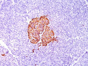 Insulin / IRDN (beta-Cell & Insulinoma Marker) Antibody - With BSA and Azide
