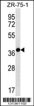 TNMD Antibody (Center)