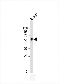 CALR Antibody (Center)
