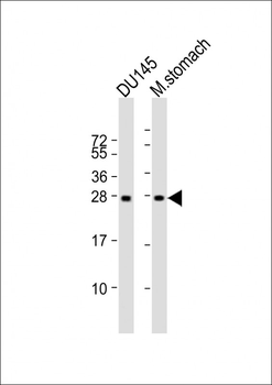 RAB27B Antibody