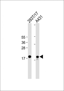 UBE2C Antibody (C-term)