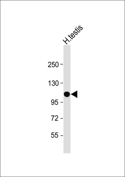 SLC14A2 Antibody (N-Term)