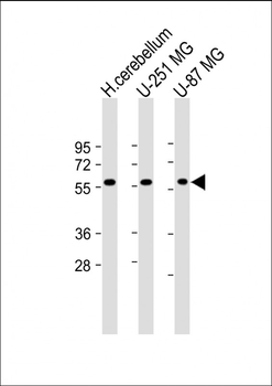 SHC2 Antibody (N-Term)