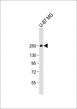 SCN1A Antibody (Center)