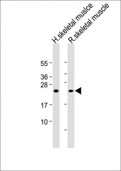 MYL1 Antibody (N-Term)
