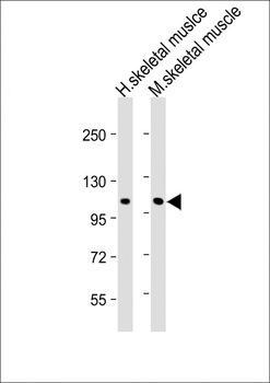 CLCN1 Antibody (N-Term)