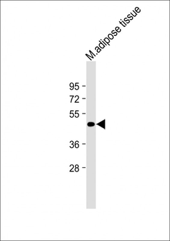 TNMD Antibody