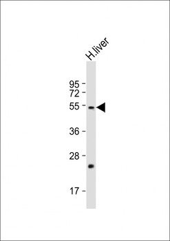 FADS2 Antibody