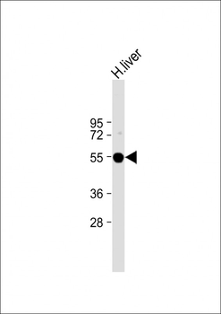 FADS2 Antibody