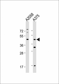 ST8SIA1 Antibody (N-Term)