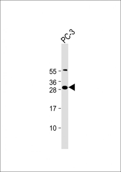FAM125A Antibody (N-Term)