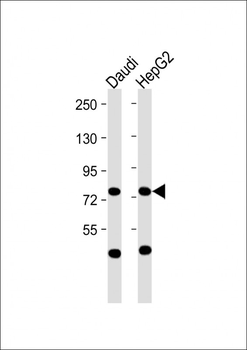 MPL Antibody (N-Term)