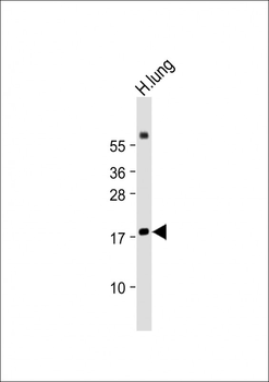 RARRES2 Antibody (Center)