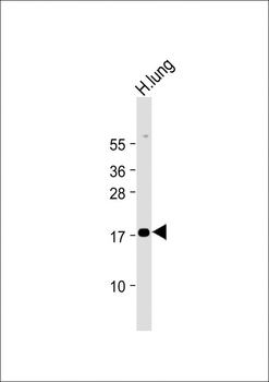 RARRES2 Antibody (N-Term)