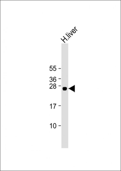 GSTA5 Antibody (Center)