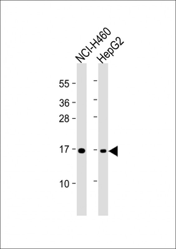 IFITM3 Antibody (N-term)