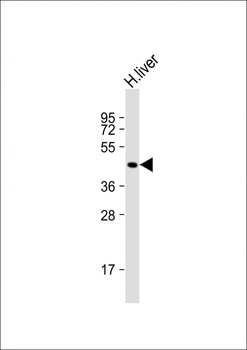 GCNT2 Antibody (Center)