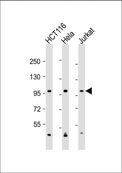 MANBA Antibody (C-Term)