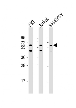 HEXDC Antibody (N-Term)