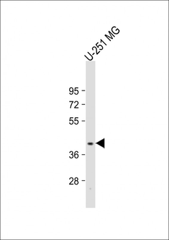 PNPLA5 Antibody (Center)