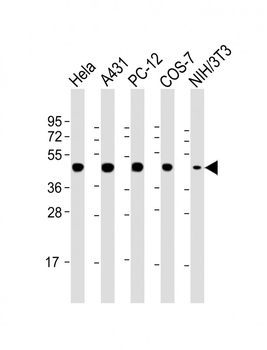 MP2K1 Antibody