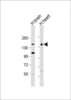 MTUS2 Antibody (C-Term)