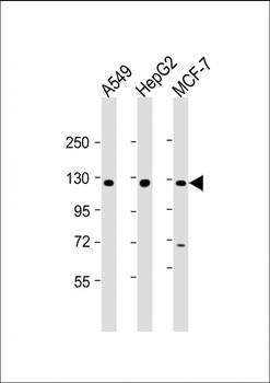 KLB Antibody (N-Term)