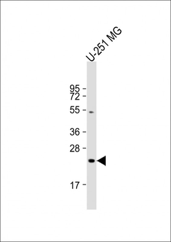 LHPP Antibody (Center)