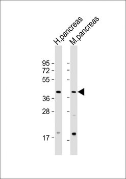 GMPPB Antibody (N-Term)