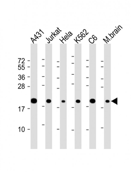 RPS10 Antibody (C-Term)
