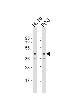 MRI1 Antibody (Center)