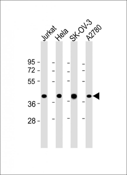 GBGT1 Antibody (Center)