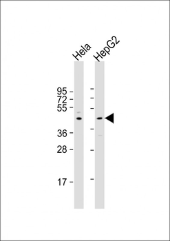 CERS2 Antibody (Center)