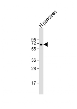 MGAT4B Antibody (N-Term)